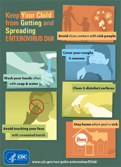 CDC Enterovirus D68 Infographic