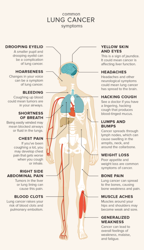 Lung Cancer Symptoms Diagram